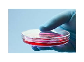 Cell culture