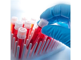Enzyme inhibitors