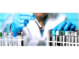 Polymerization initiators